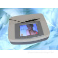 Facial Spider Vein Treatment 30mhz , Thread Vein Removal Machine